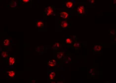 Anti-NLRP13 antibody used in Immunocytochemistry/ Immunofluorescence (ICC/IF). GTX31990