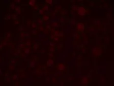 Anti-SLAIN1 antibody used in Immunocytochemistry/ Immunofluorescence (ICC/IF). GTX32052