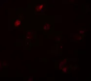 Anti-CCDC22 antibody used in IHC (Paraffin sections) (IHC-P). GTX32079