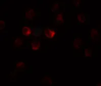 Anti-TCTEX1D1 antibody used in Immunocytochemistry/ Immunofluorescence (ICC/IF). GTX32084