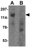 Anti-SGSM1 antibody used in Western Blot (WB). GTX32093