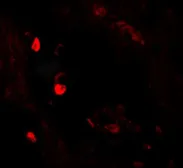 Anti-LNPEP antibody used in IHC (Paraffin sections) (IHC-P). GTX32096