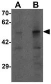 Anti-PLA1A antibody used in Western Blot (WB). GTX32097