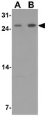 Anti-KHDC1 antibody used in Western Blot (WB). GTX32118