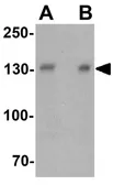 Anti-PPFIA3 antibody used in Western Blot (WB). GTX32124