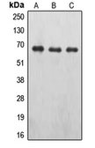 Anti-EPO receptor (phospho Tyr426) antibody used in Western Blot (WB). GTX32177