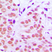 Anti-c-Jun (phospho Thr91) antibody used in IHC (Paraffin sections) (IHC-P). GTX32204