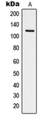 Anti-FAK (phospho Tyr925) antibody used in Western Blot (WB). GTX32252