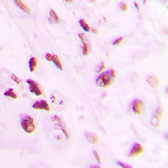 Anti-p73 (phospho Tyr99) antibody used in IHC (Paraffin sections) (IHC-P). GTX32277