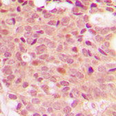 Anti-HDAC5 (phospho Ser498) antibody used in IHC (Paraffin sections) (IHC-P). GTX32287