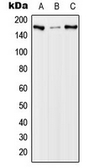 Anti-EGFR (phospho Thr654) antibody used in Western Blot (WB). GTX32321