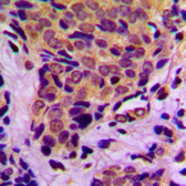 Anti-4E-BP1 (phospho Thr37) antibody used in IHC (Paraffin sections) (IHC-P). GTX32322