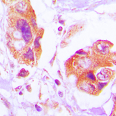 Anti-Filamin A (phospho Ser2152) antibody used in IHC (Paraffin sections) (IHC-P). GTX32328