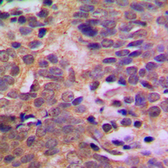 Anti-MDM2 (phospho Ser166) antibody used in IHC (Paraffin sections) (IHC-P). GTX32336