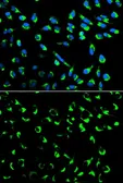Anti-14-3-3 sigma antibody used in Immunocytochemistry/ Immunofluorescence (ICC/IF). GTX32418
