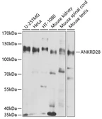 Anti-ANKRD28 antibody used in Western Blot (WB). GTX32442