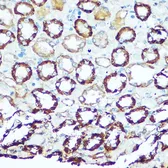 Anti-ATP5H antibody used in IHC (Paraffin sections) (IHC-P). GTX32460