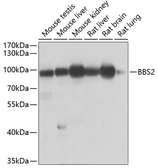 Anti-BBS2 antibody used in Western Blot (WB). GTX32466