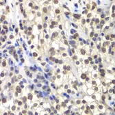 Anti-CENPC antibody used in IHC (Paraffin sections) (IHC-P). GTX32516