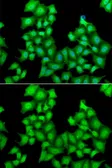 Anti-CPSF3L antibody used in Immunocytochemistry/ Immunofluorescence (ICC/IF). GTX32537