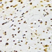 Anti-DBC1 antibody used in IHC (Paraffin sections) (IHC-P). GTX32552