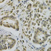 Anti-EBAG9 antibody used in IHC (Paraffin sections) (IHC-P). GTX32570
