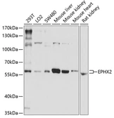 Anti-EPXH2 antibody used in Western Blot (WB). GTX32591