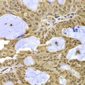 Anti-Exportin 5 antibody used in IHC (Paraffin sections) (IHC-P). GTX32594