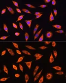Anti-GALNS antibody used in Immunocytochemistry/ Immunofluorescence (ICC/IF). GTX32618