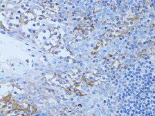 Anti-HADH antibody used in IHC (Paraffin sections) (IHC-P). GTX32641