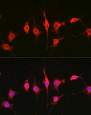 Anti-Heparanase 1 antibody used in Immunocytochemistry/ Immunofluorescence (ICC/IF). GTX32650