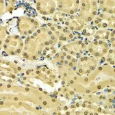 Anti-hnRNP A2B1 antibody used in IHC (Paraffin sections) (IHC-P). GTX32657