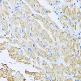 Anti-IL18BP antibody used in IHC (Paraffin sections) (IHC-P). GTX32676