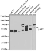 Anti-LIPF antibody used in Western Blot (WB). GTX32705