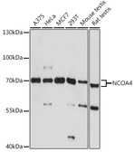 Anti-NCOA4 antibody used in Western Blot (WB). GTX32739