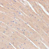 Anti-NHLRC1 antibody used in IHC (Paraffin sections) (IHC-P). GTX32750