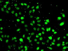 Anti-NUDT2 antibody used in Immunocytochemistry/ Immunofluorescence (ICC/IF). GTX32760