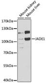 Anti-PHF17 antibody used in Western Blot (WB). GTX32786
