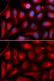 Anti-PSMA5 antibody used in Immunocytochemistry/ Immunofluorescence (ICC/IF). GTX32817