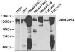 Anti-RICH2 antibody used in Western Blot (WB). GTX32841