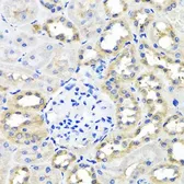 Anti-SCG3 antibody used in IHC (Paraffin sections) (IHC-P). GTX32859