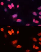 Anti-SIRT1 antibody used in Immunocytochemistry/ Immunofluorescence (ICC/IF). GTX32875