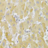 Anti-SLUG antibody used in IHC (Paraffin sections) (IHC-P). GTX32879