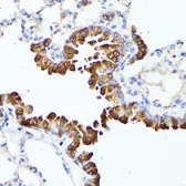 Anti-SMYD4 antibody used in IHC (Paraffin sections) (IHC-P). GTX32886