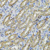 Anti-SPTLC1 antibody used in IHC (Paraffin sections) (IHC-P). GTX32895