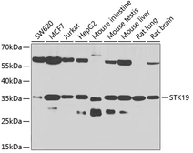 Anti-STK19 antibody used in Western Blot (WB). GTX32901