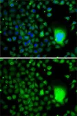 Anti-TAF5 antibody used in Immunocytochemistry/ Immunofluorescence (ICC/IF). GTX32908