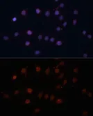 Anti-TOM70 antibody used in Immunocytochemistry/ Immunofluorescence (ICC/IF). GTX32929