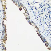 Anti-Troponin C fast skeletal antibody used in IHC (Paraffin sections) (IHC-P). GTX32938