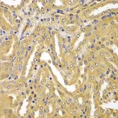 Anti-UBE2Z antibody used in IHC (Paraffin sections) (IHC-P). GTX32945